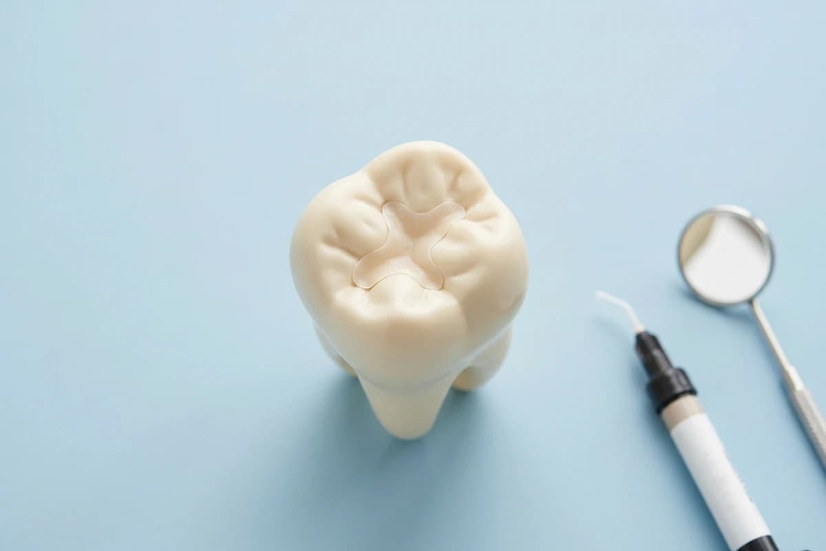 Illustrative molar model with a small tooth-colored filling and unbranded restorative materials.